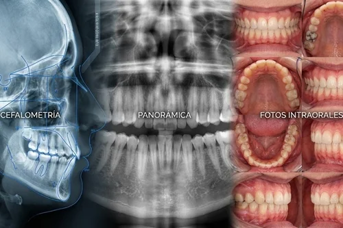 paquetes de ortodoncia