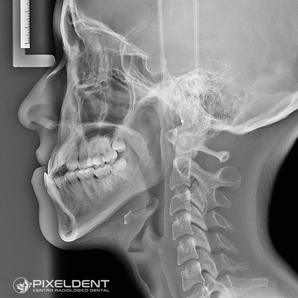 radiografia-cefalométrica-en-lima.