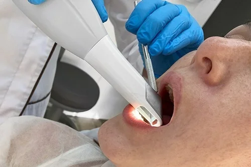 Radiografía panorámica Escaneo oral 3D