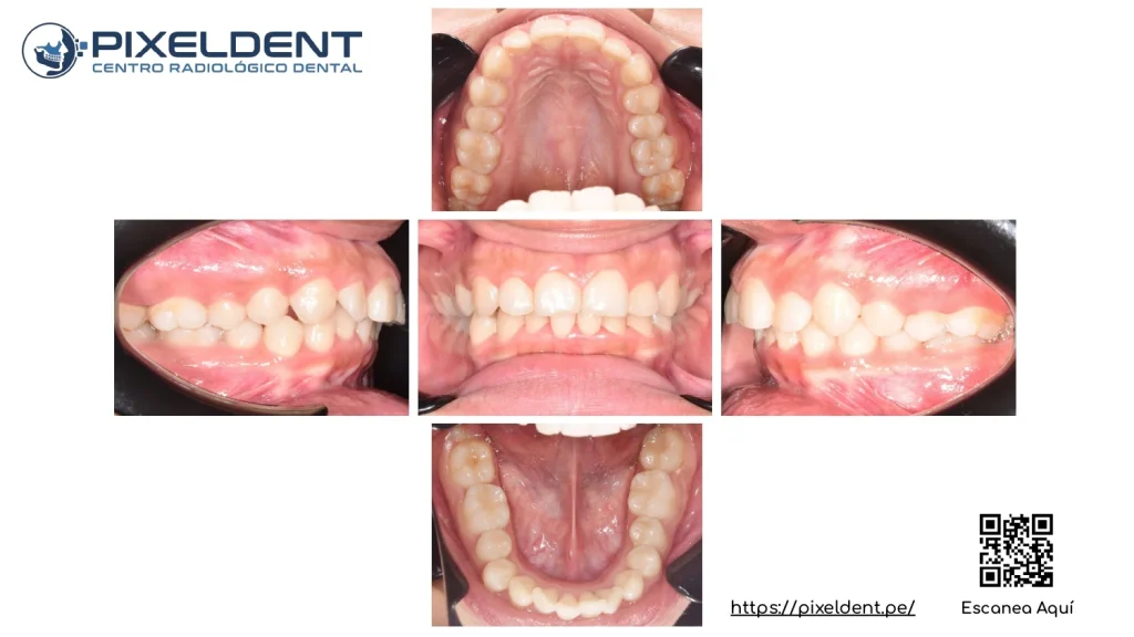 Fotos intraorales dentales
